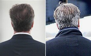 David Cameron Grey Hair